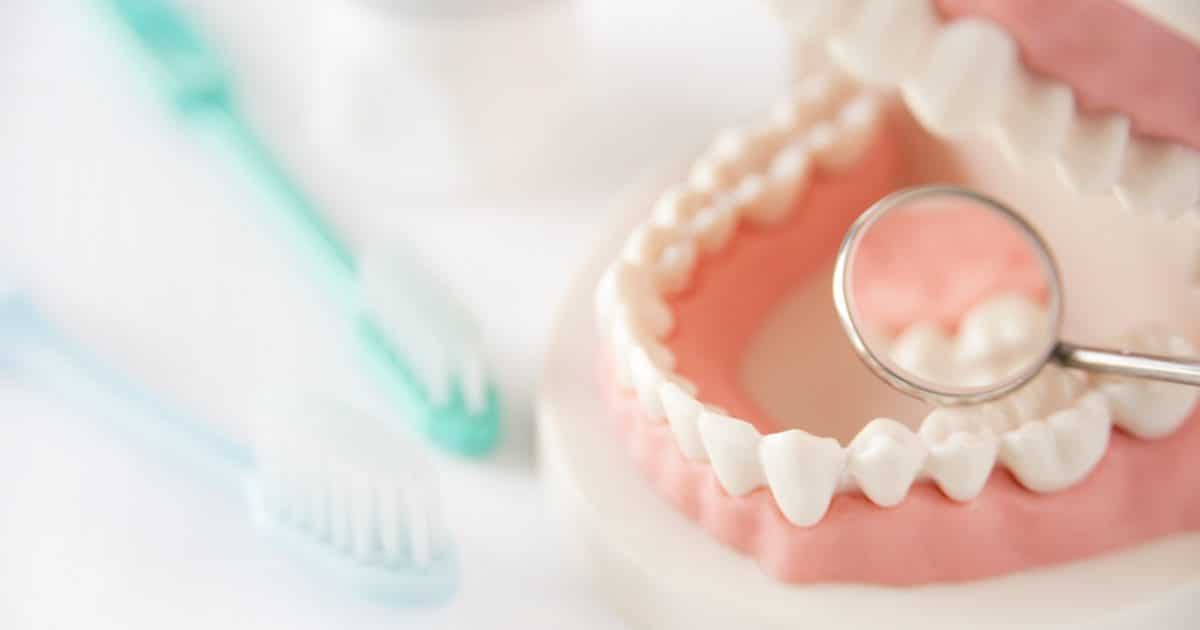 支台歯形成のクリアランス作成方法は？確認方法や歯による違いも解説
