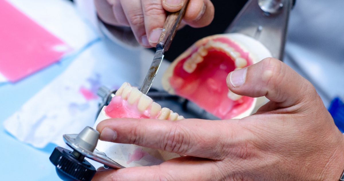 義歯作成のために印象採得するコツとは？やり方や嘔吐反射を防ぐ方法も解説